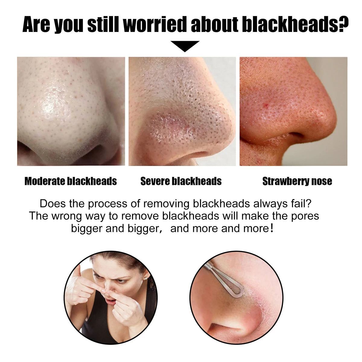 Deep Cleansing Blackhead Nose Patch