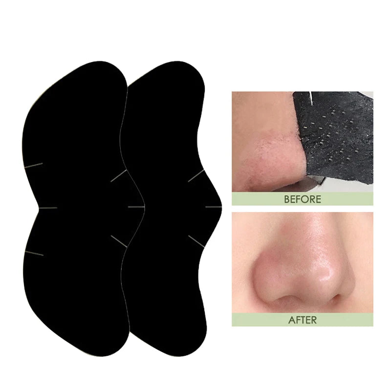 Deep Cleansing Blackhead Nose Patch