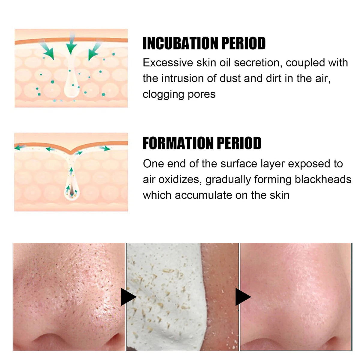 Deep Cleansing Blackhead Nose Patch