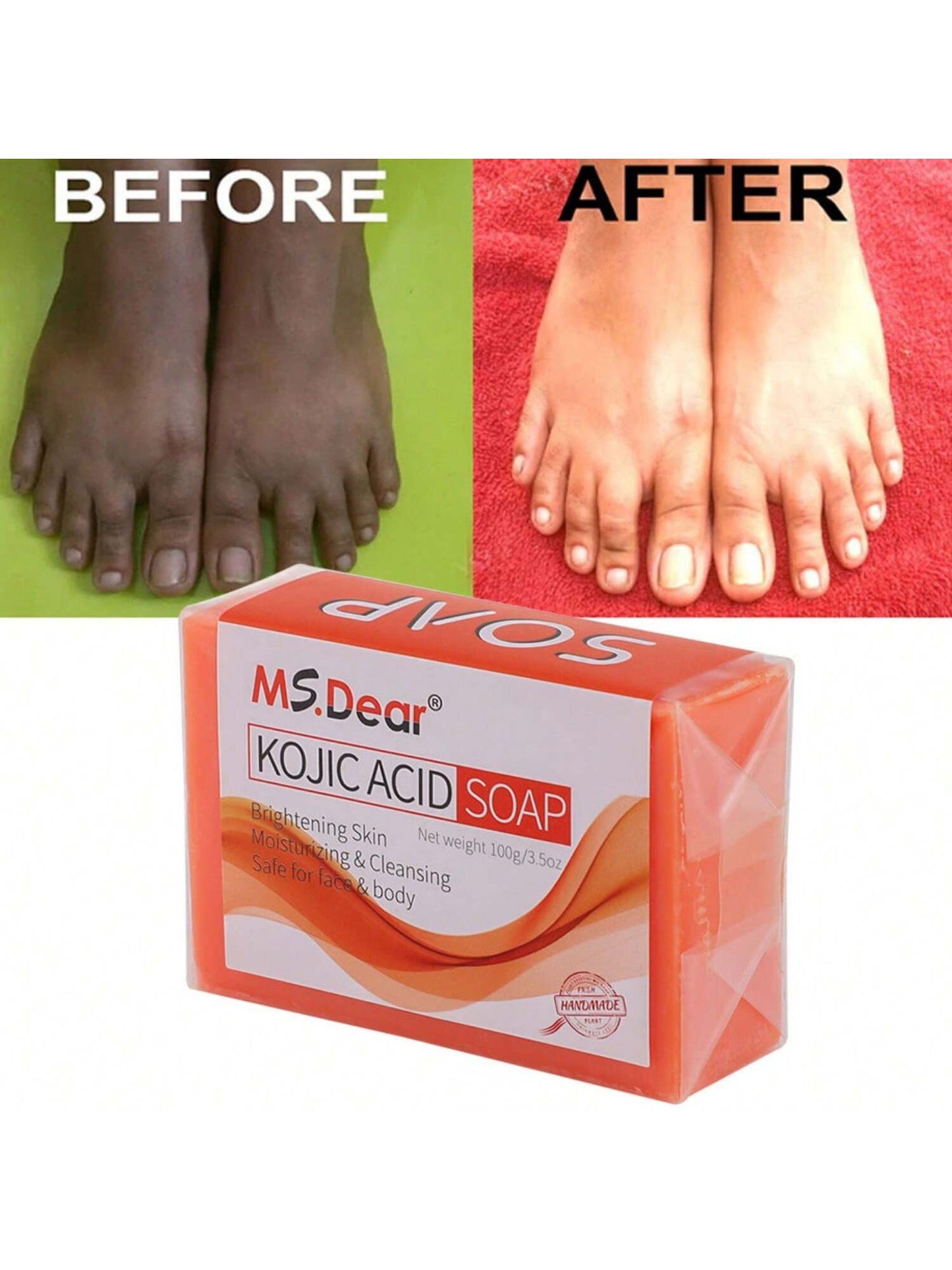 Kojic Acid Whitening Soap