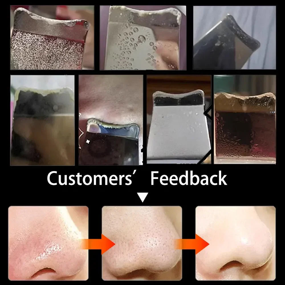 Electric Facial Pore Cleansing Spatula