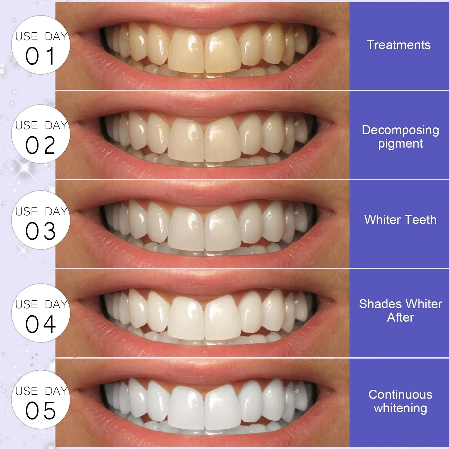 5D Teeth Whitening Gel Strips