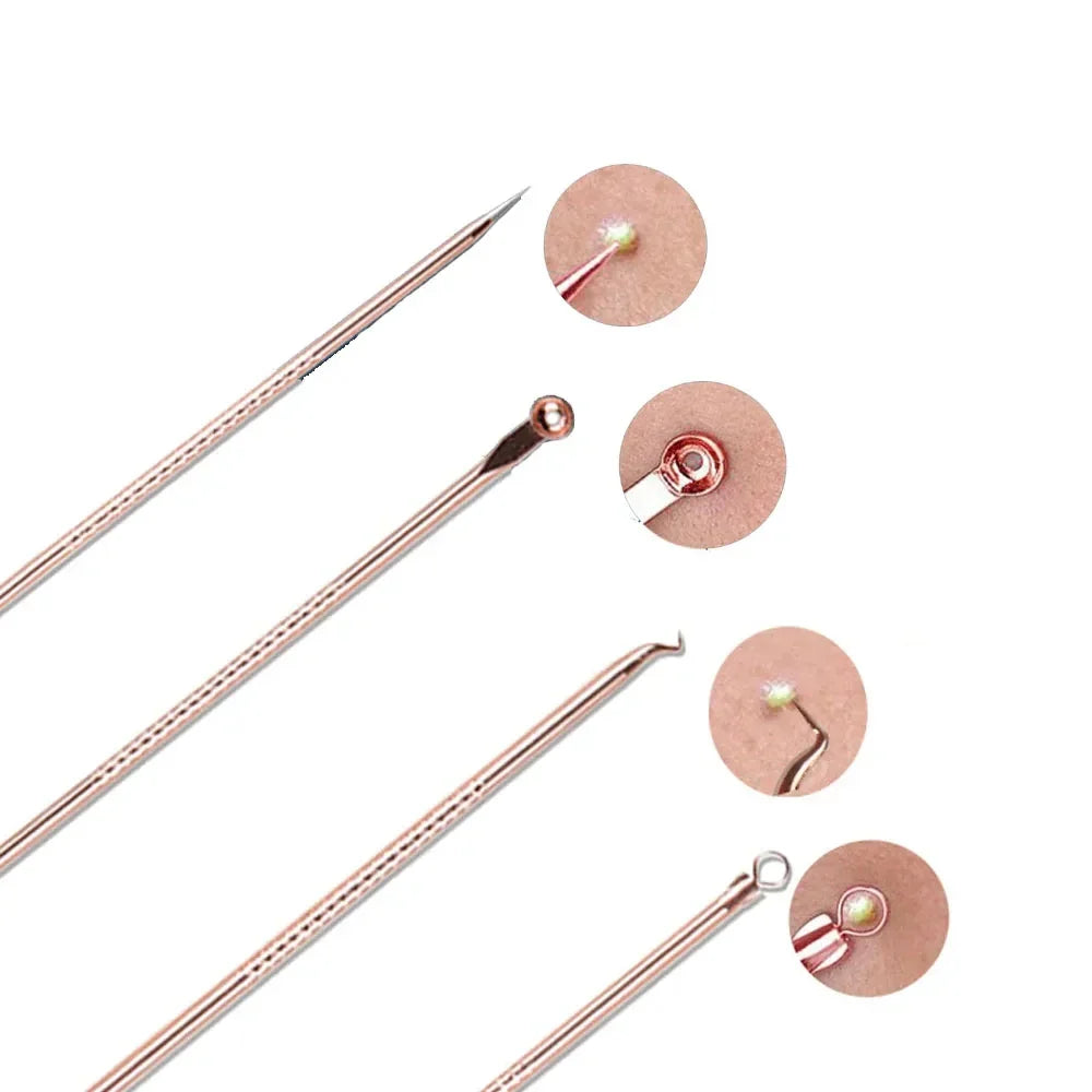 4PCS Blackhead Removal Needle Set