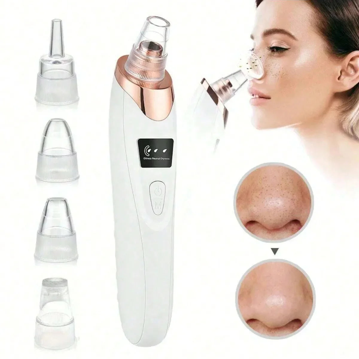 Electric Blackhead Remover Vacuum Cleanser