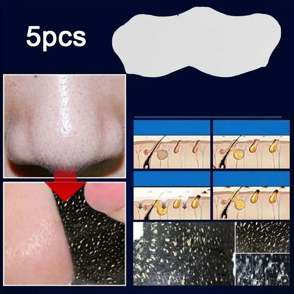 Blackhead Remover Nose Patches