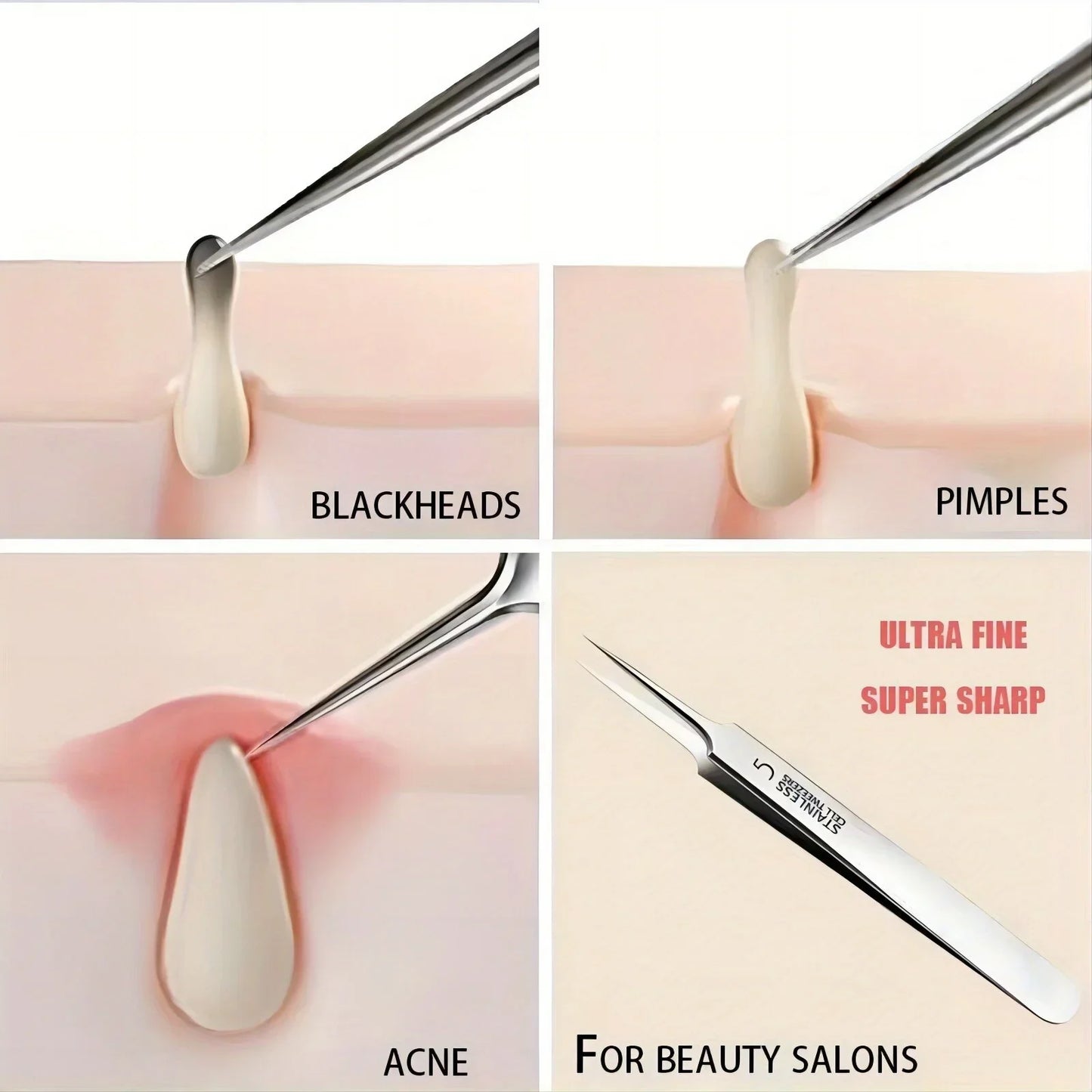 Ultra-Fine Acne Blackhead Tweezer