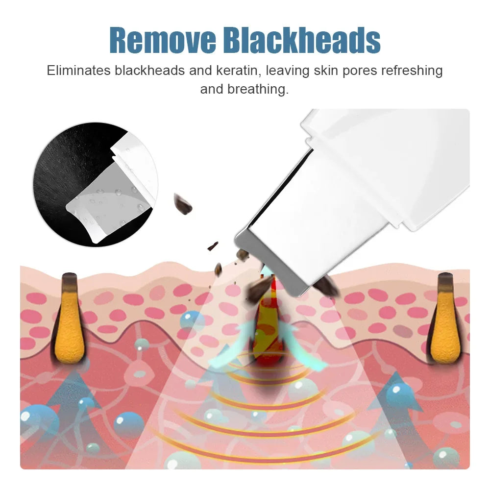 Ultrasonic Blackhead Remover Facial Cleaner