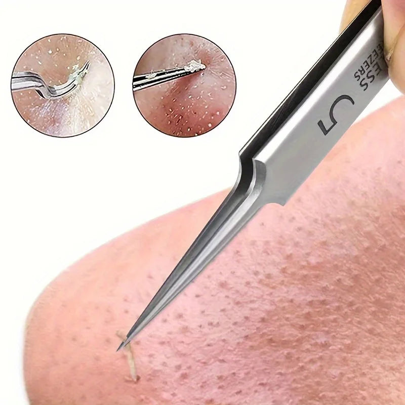 Ultra-Fine Acne Blackhead Tweezer