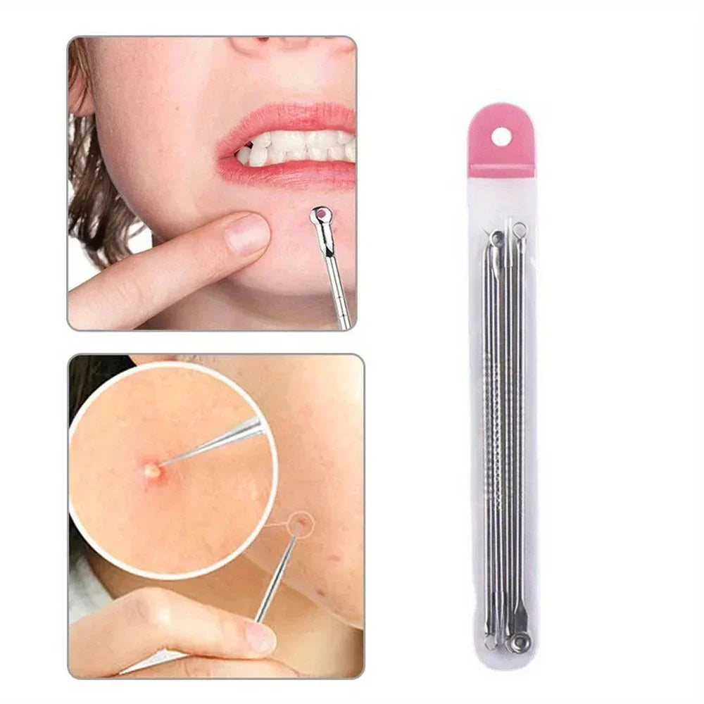 Blackhead Acne Pimple Extractor Kit