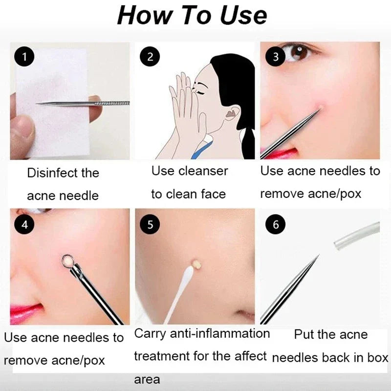 4PCS Blackhead Removal Needle Set